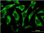 RPL17 Antibody in Immunocytochemistry (ICC/IF)