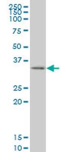 SIX3 Antibody in Western Blot (WB)