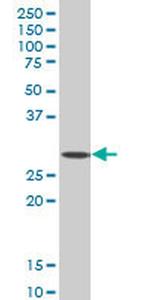 SIX3 Antibody in Western Blot (WB)