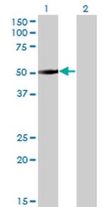 ZNF213 Antibody in Western Blot (WB)