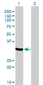 ZNF215 Antibody in Western Blot (WB)