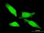 Tesmin Antibody in Immunocytochemistry (ICC/IF)