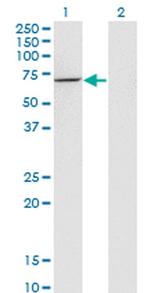 USH1C Antibody in Western Blot (WB)