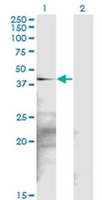 SGK2 Antibody in Western Blot (WB)