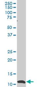 SNAPC5 Antibody in Western Blot (WB)