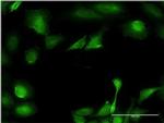 B3GNT3 Antibody in Immunocytochemistry (ICC/IF)