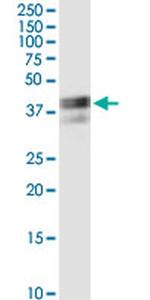 RUNDC3A Antibody in Western Blot (WB)