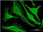 SALF Antibody in Immunocytochemistry (ICC/IF)