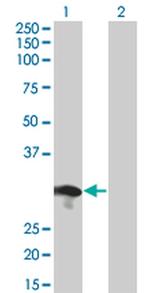 RABL2B Antibody in Western Blot (WB)