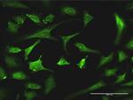 EXOSC8 Antibody in Immunocytochemistry (ICC/IF)