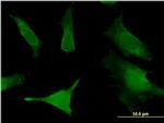 SLC6A16 Antibody in Immunocytochemistry (ICC/IF)