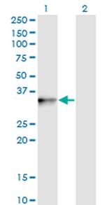 PIH1D1 Antibody in Western Blot (WB)