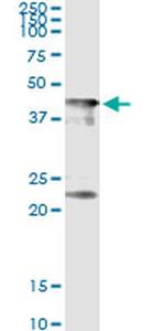 CENPJ Antibody in Immunoprecipitation (IP)