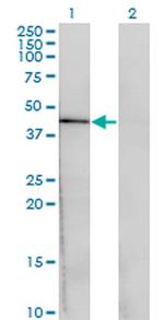 CENPJ Antibody in Western Blot (WB)