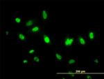 ITFG2 Antibody in Immunocytochemistry (ICC/IF)