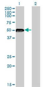 ZNF71 Antibody in Western Blot (WB)