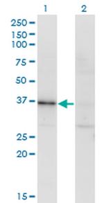 RBKS Antibody in Western Blot (WB)