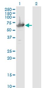 MCCC2 Antibody in Western Blot (WB)