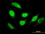 SNX29 Antibody in Immunocytochemistry (ICC/IF)