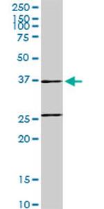 SNX29 Antibody in Western Blot (WB)