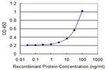 SLC25A21 Antibody in ELISA (ELISA)