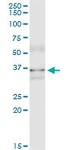 MSI2 Antibody in Immunoprecipitation (IP)