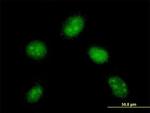 DYDC1 Antibody in Immunocytochemistry (ICC/IF)