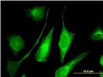 Adenylate Kinase 9 Antibody in Immunocytochemistry (ICC/IF)