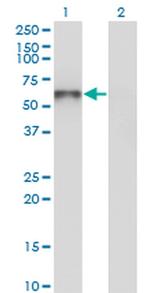 UNC5CL Antibody in Western Blot (WB)