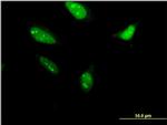 RNF212 Antibody in Immunocytochemistry (ICC/IF)