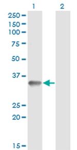 RNF212 Antibody in Western Blot (WB)