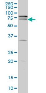 ZNF181 Antibody in Western Blot (WB)