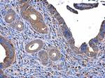 ME1 Antibody in Immunohistochemistry (Paraffin) (IHC (P))