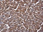 ME1 Antibody in Immunohistochemistry (Paraffin) (IHC (P))