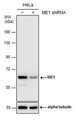 ME1 Antibody