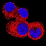 IL4R Antibody in Immunocytochemistry (ICC/IF)