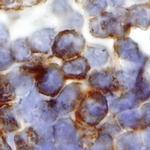 IL4R Antibody in Immunohistochemistry (Paraffin) (IHC (P))