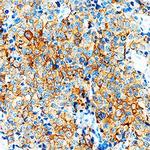 VEGFB Antibody in Immunohistochemistry (Paraffin) (IHC (P))