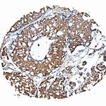 FGF19 Antibody in Immunohistochemistry (Paraffin) (IHC (P))