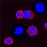 TREM1 Antibody in Immunocytochemistry (ICC/IF)