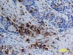 CEACAM1 Antibody in Immunohistochemistry (Paraffin) (IHC (P))