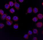 CSF2RA Antibody in Immunocytochemistry (ICC/IF)