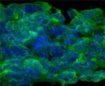 OSMR Antibody in Immunocytochemistry (ICC/IF)