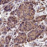 DLL1 Antibody in Immunohistochemistry (Paraffin) (IHC (P))