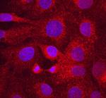 LRP6 Antibody in Immunocytochemistry (ICC/IF)