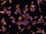 FABP5 Antibody in Immunocytochemistry (ICC/IF)