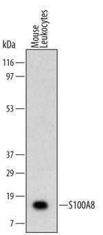 S100A8 Antibody in Western Blot (WB)