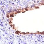 CD109 Antibody in Immunohistochemistry (Paraffin) (IHC (P))