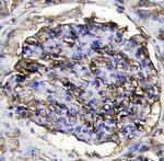 Thrombomodulin Antibody in Immunohistochemistry (Paraffin) (IHC (P))