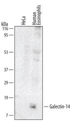 Galectin 14 Antibody in Western Blot (WB)